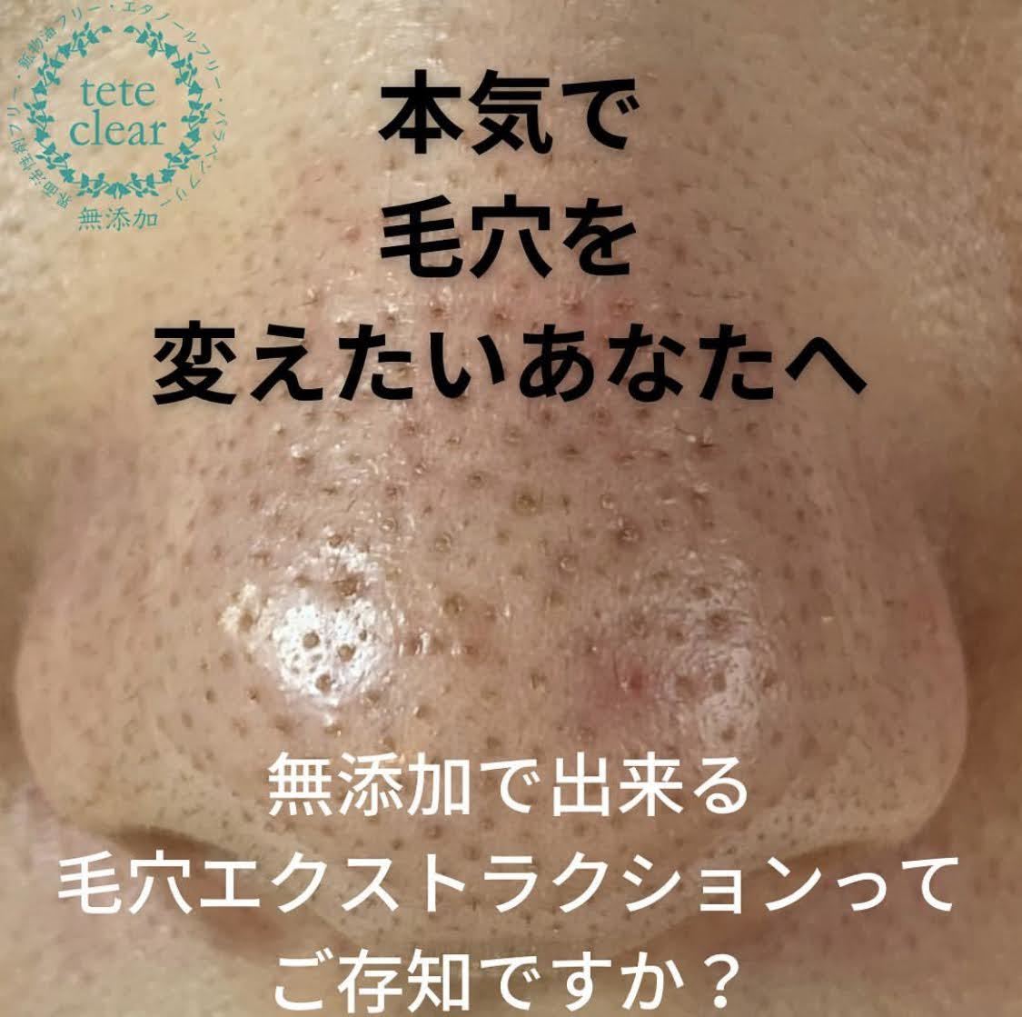 の紹介画像