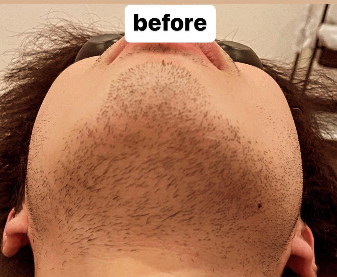 メンズ脱毛サロン Mr.Smooth 【ミスタースムース】の紹介画像