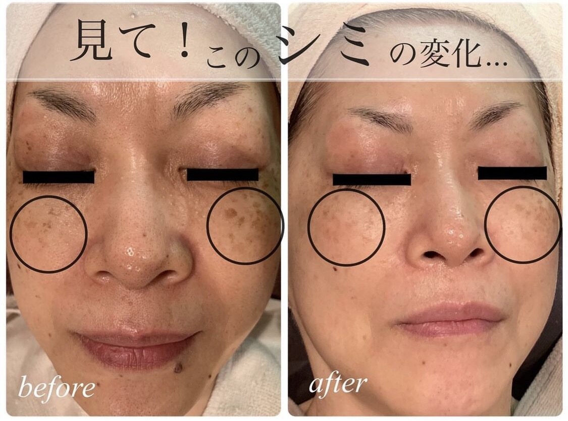 ビーフリー(Be free)の紹介画像