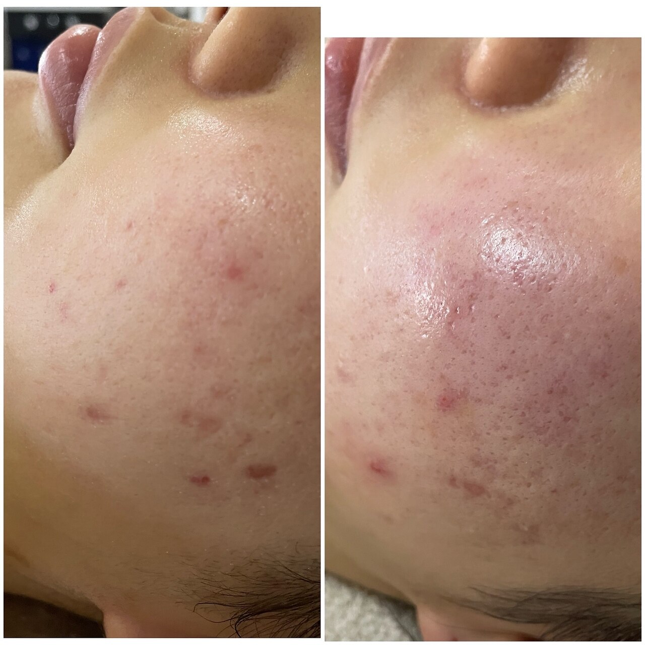 メンズ脱毛サロン Mr.Smooth 【ミスタースムース】の紹介画像