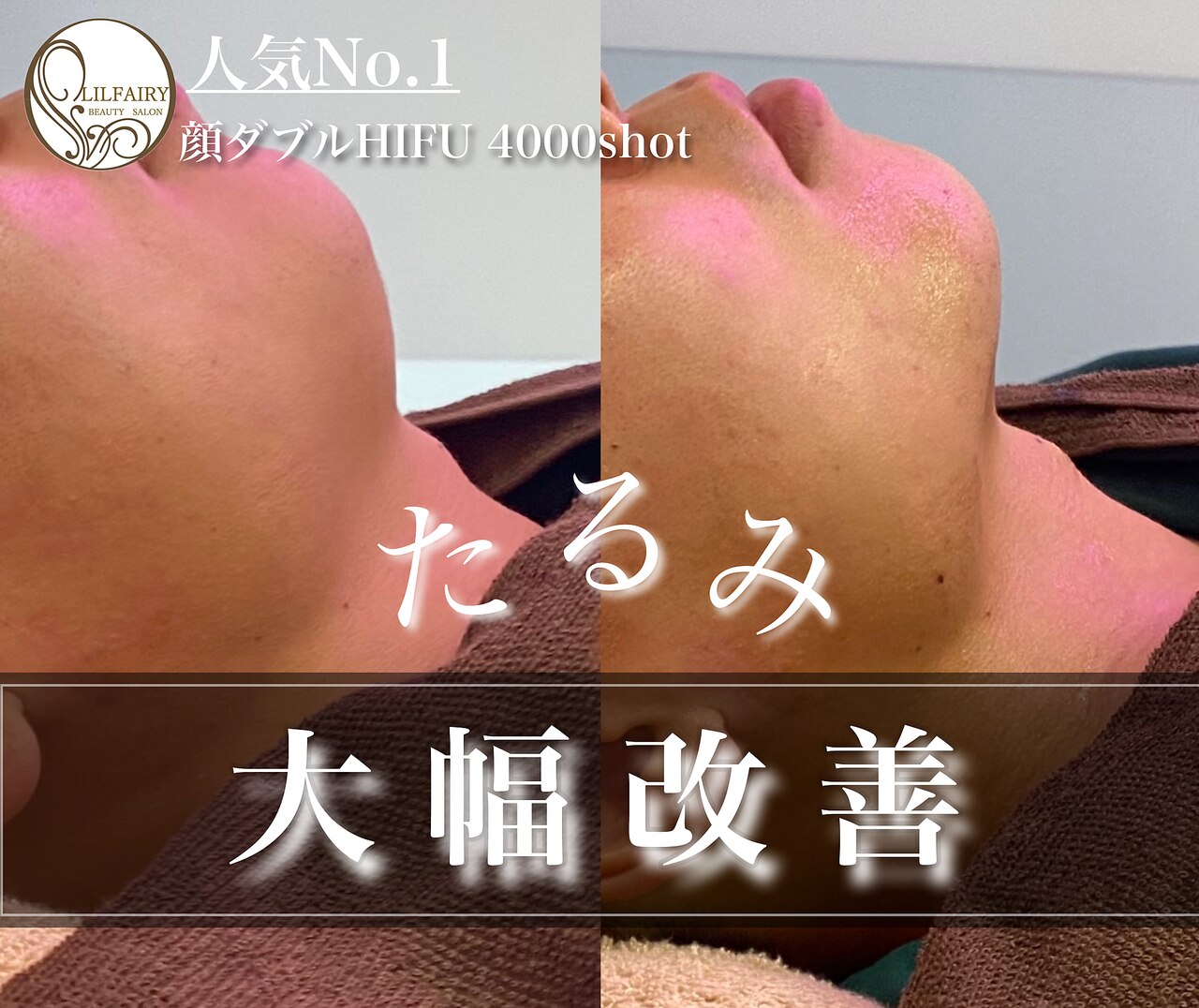 メンズ脱毛サロン Mr.Smooth 【ミスタースムース】の紹介画像