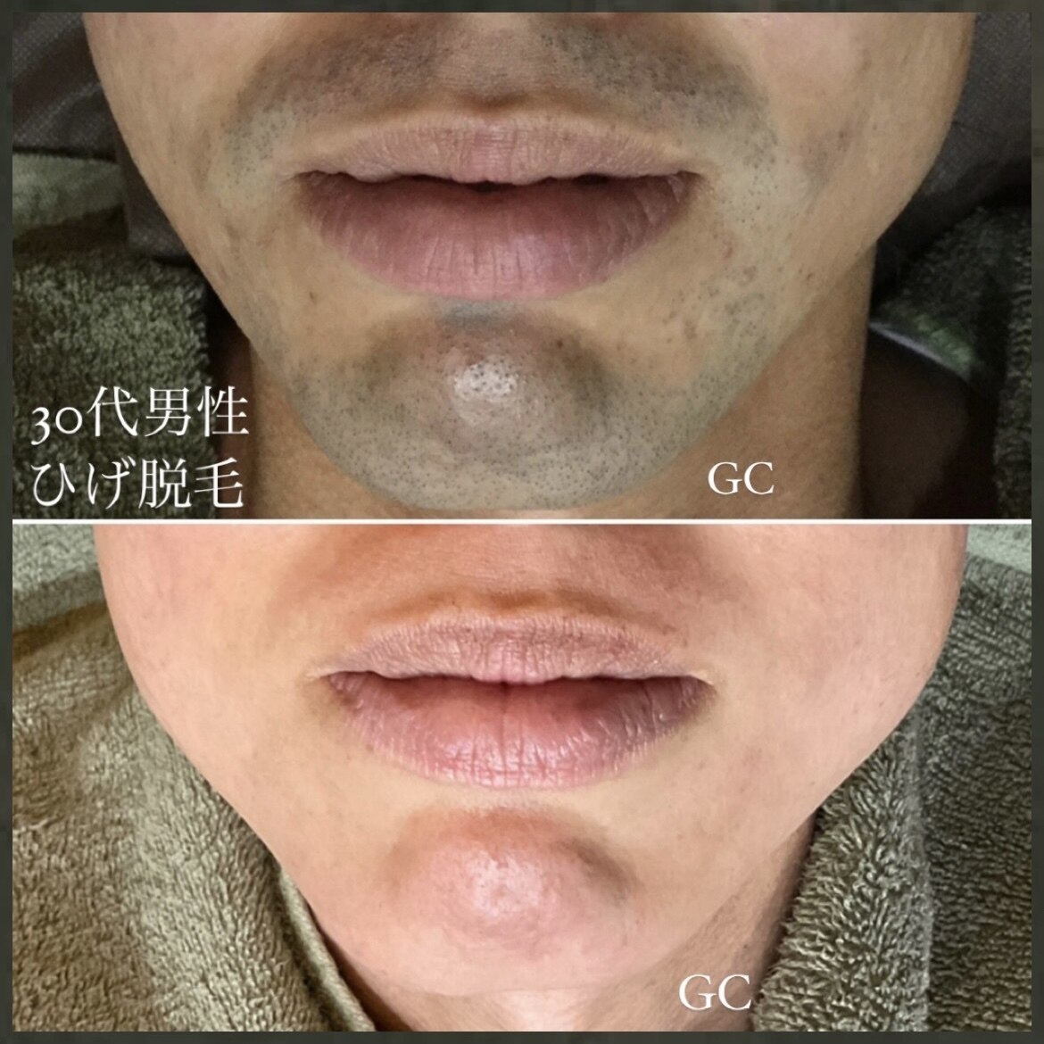 メンズ脱毛サロン Mr.Smooth 【ミスタースムース】の紹介画像