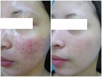 フェイシャル専門店 エピア 掛川店(Epia)の紹介画像